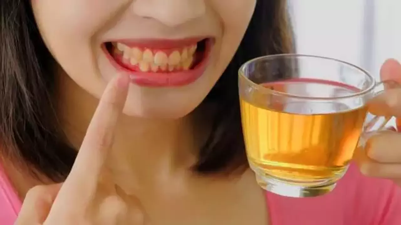Dişleri en çok ne sarartır? İlk sigara diyenler yanılıyor